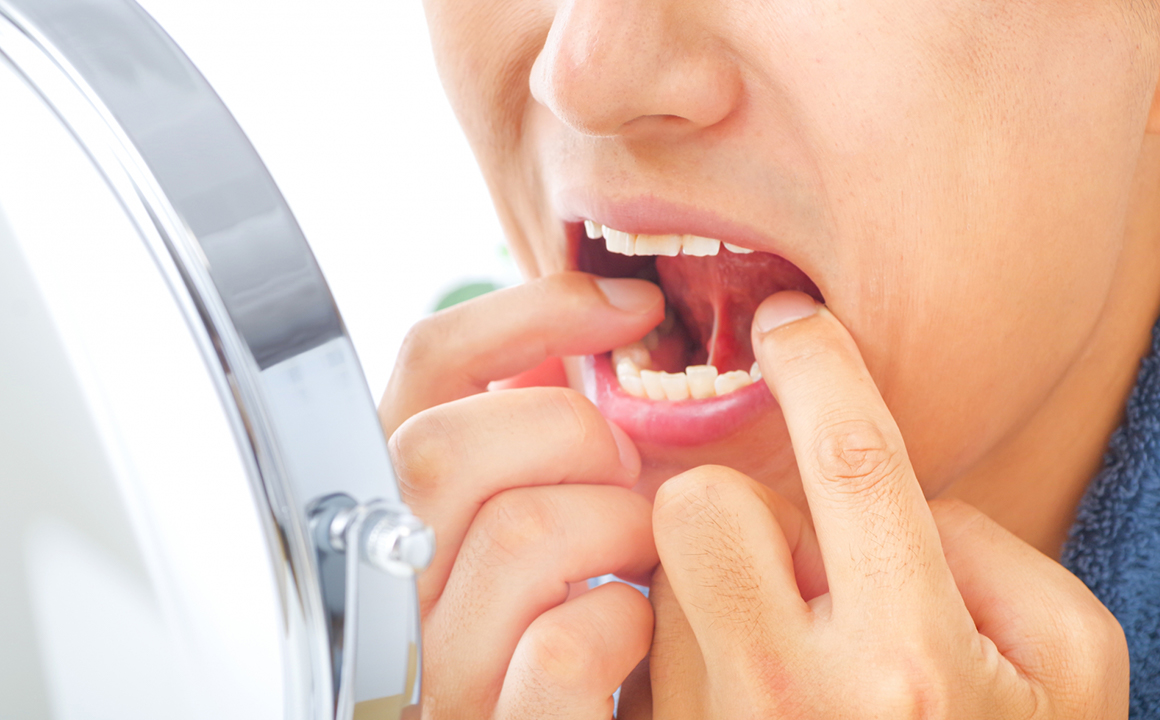 外傷・骨折イメージ